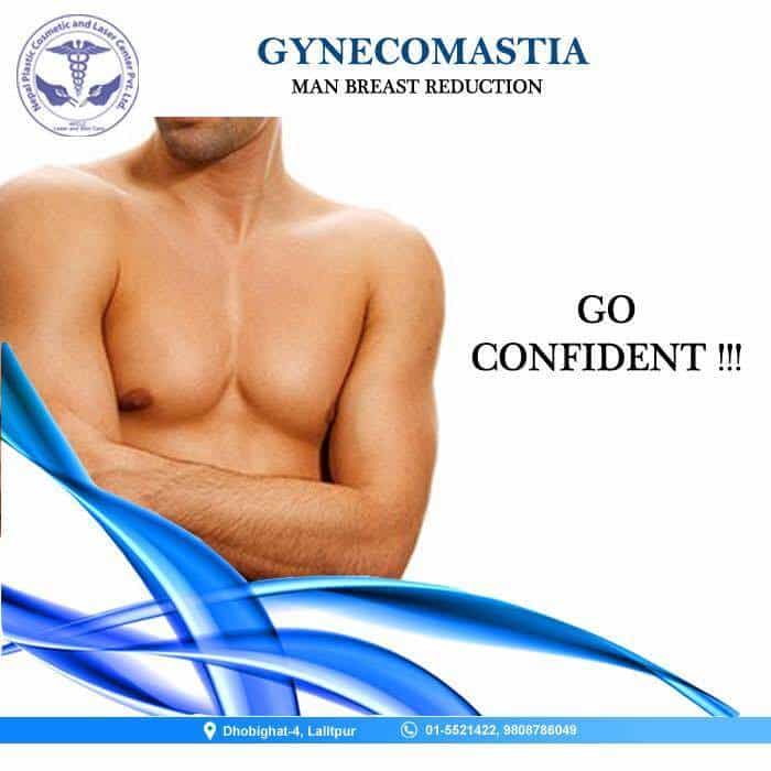 gynecomastia men breast reduction surgery in nepal