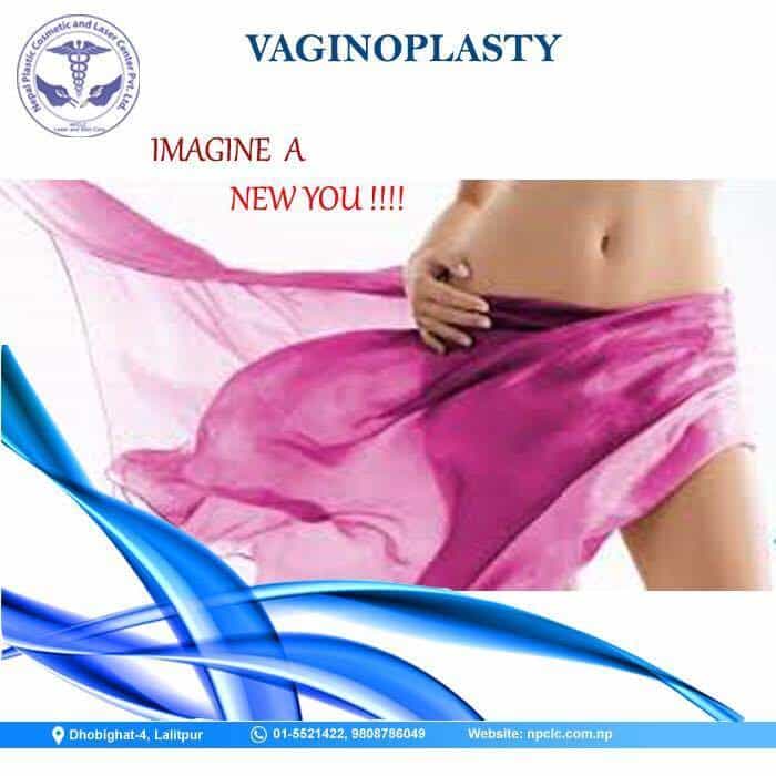 vagina surgery in nepal
