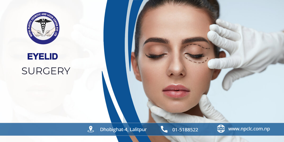 eyelid surgery in NP