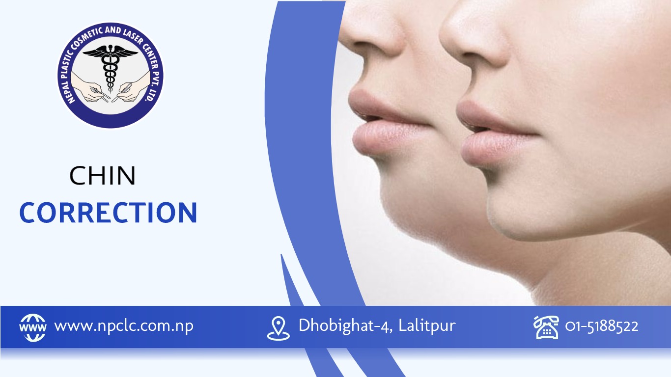 chin correction in nepal