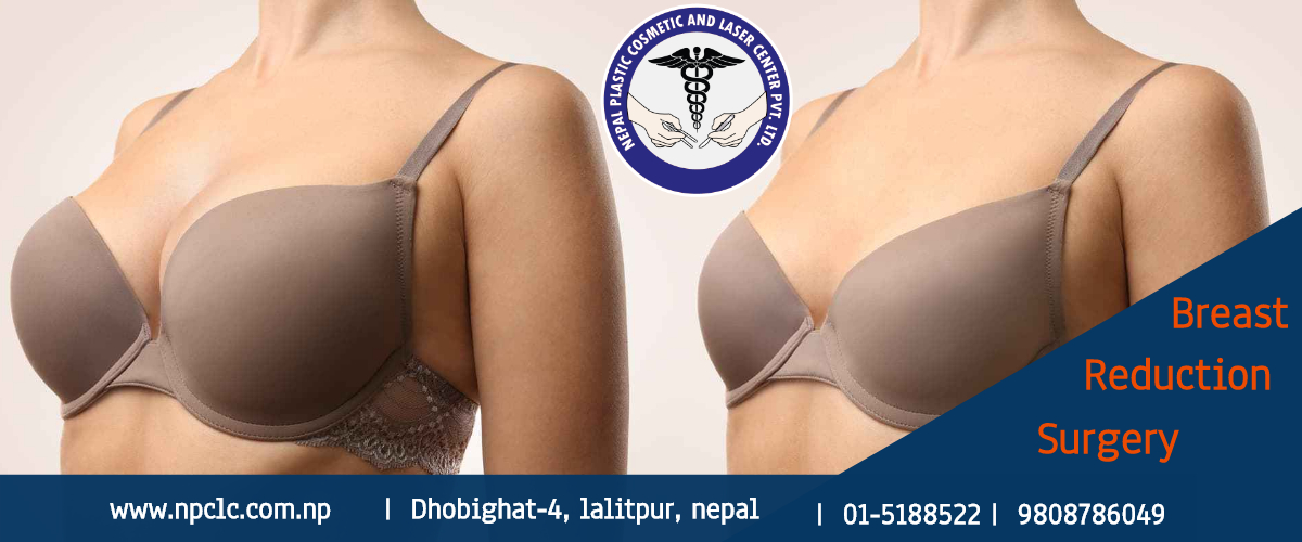 breast reduction surgery in Kathmandu